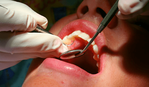 Enfermedad periodontal en Mallorca