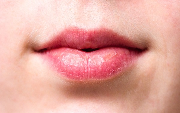 Cáncer oral. Vigila tu boca para evitar el cáncer oral